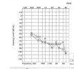 audiogram2.jpg