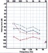 audiogram.jpg