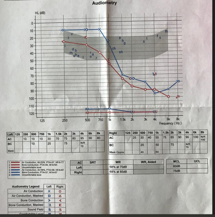 Volusiano's audiogram 2023-09-09 093540.png